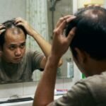 Rambut Rontok, Coba Pakai Bawang Putih Selama 60 Hari