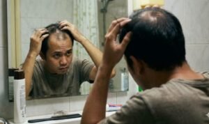 Rambut Rontok, Coba Pakai Bawang Putih Selama 60 Hari